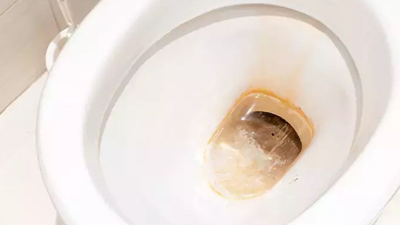 Sararan tuvaleti pırıl pırıl yapan taktikler! Her evde bu malzemeler var