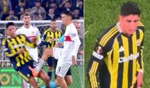 Fenerbahçe'yi isyan ettiren pozisyon! Alvarez'in bacağındaki yara gündem oldu