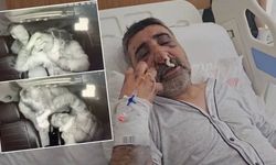 İngiliz boksörün darp ettiği taksici ilk kez konuştu: Öptü, ısırdı, gözümü yırtmaya çalıştı