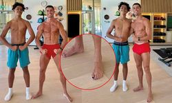 Ronaldo ayak tırnaklarına neden siyah oje sürüyor?