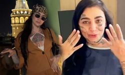 Yabancı fenomen İstanbul'da ameliyat masasından kalkamadı