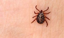 Profesör uyardı! Vücudunuza kene yapışırsa ne yapmalısınız?