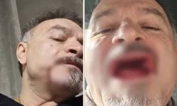 Sahte diş doktoru dehşeti yaşattı! Klinik ise hala açık