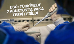 İngiltere'den vatandaşlarına Türkiye uyarısı: 'Maymun çiçeği' var