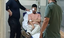 Gözüne çivi saplanan işçi görme yetisini kaybetti