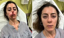 Eşinin sevgilisi sanıp darp etmişti! Otomobil kapısı silah sayıldı