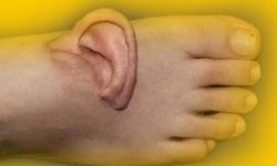 İş kazası geçiren kadına inanılmaz müdahale! Kopan kulak bakın nereye dikildi