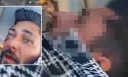 Vatandaş taciz şüphelisini dövüp jandarmaya teslim etti