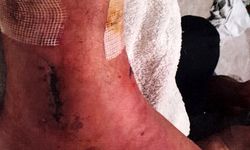 Arkeolojik kazı alanındaki çukura düştü 1 milyon lira tazminat kazandı