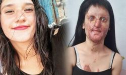 Berfin Özek’e asitli saldırıda bulunan şahıs hakkında istenen ceza belli oldu