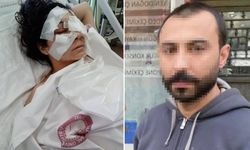 'Ağabey' demeyen yengesini biri gözünden defalarca kez bıçakladı