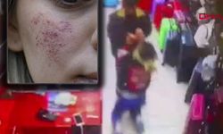 Kadına dükkan ortasında nişanlısından öldüresiye dayak!