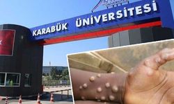 5 binden fazla Afrikalı öğrencisi olan Karabük Üniversitesi'nden 'M çiçeği' açıklaması