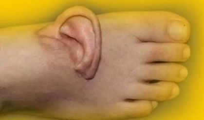 İş kazası geçiren kadına inanılmaz müdahale! Kopan kulak bakın nereye dikildi