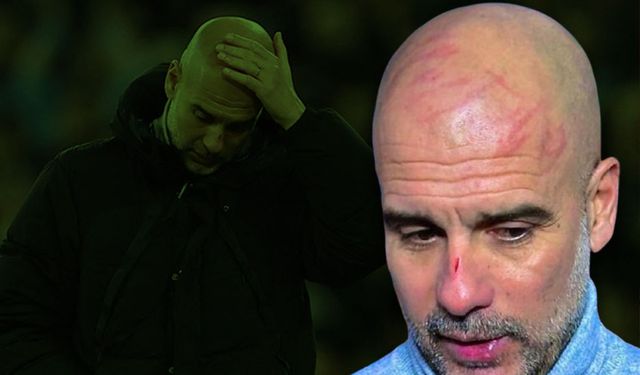 Guardiola kontrolü kaybetti! Yüzündeki yaraların sebebini maç sonunda açıkladı