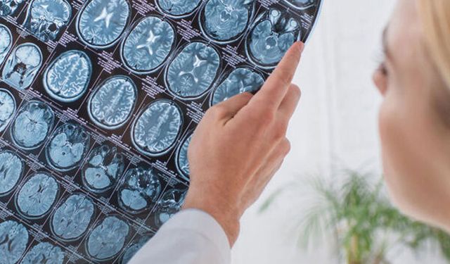 3 ayda 9 ameliyat geçirdi! Tedavi sürecinde kafatasını midesinde taşıdı