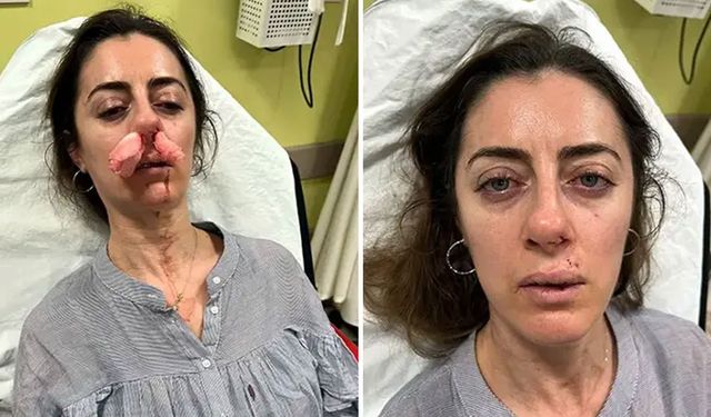 Eşinin sevgilisi sanıp darp etmişti! Otomobil kapısı silah sayıldı