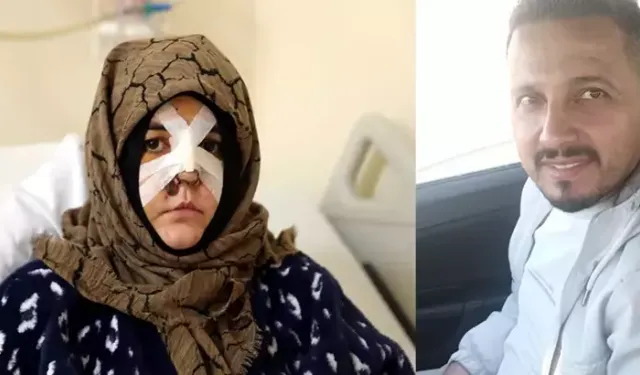 Boşanma aşamasındaki eşine vurduğu kaldırım taşı 'silah' sayıldı