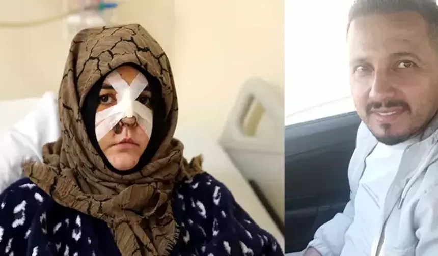 Boşanma aşamasındaki eşine vurduğu kaldırım taşı 'silah' sayıldı