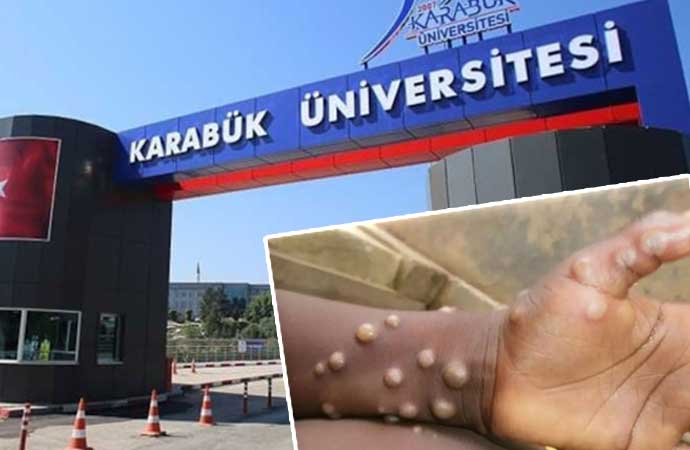 Karabük Üniversitesi, M çiçeği